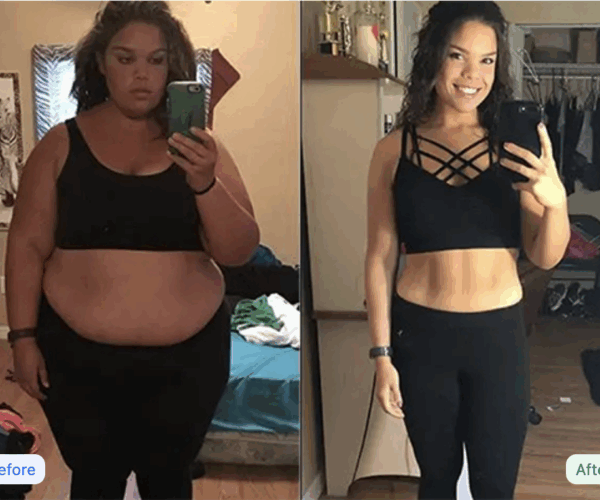 Thinnex-before-and-after-girl-in-black-set