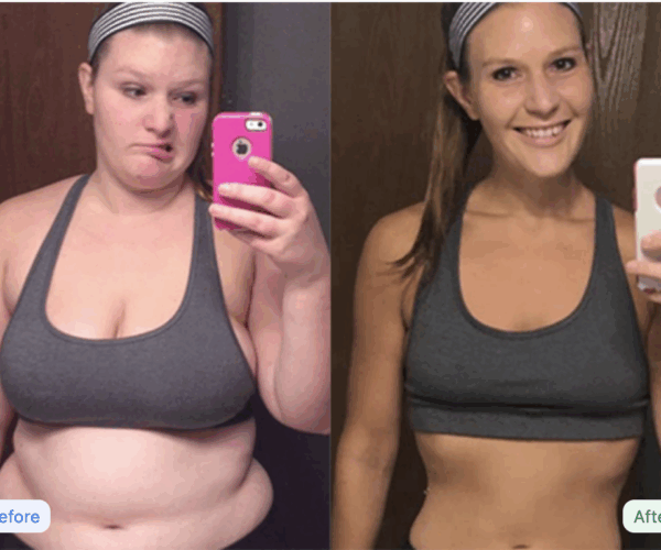 Thinnex-before-and-after-girl-in-gray